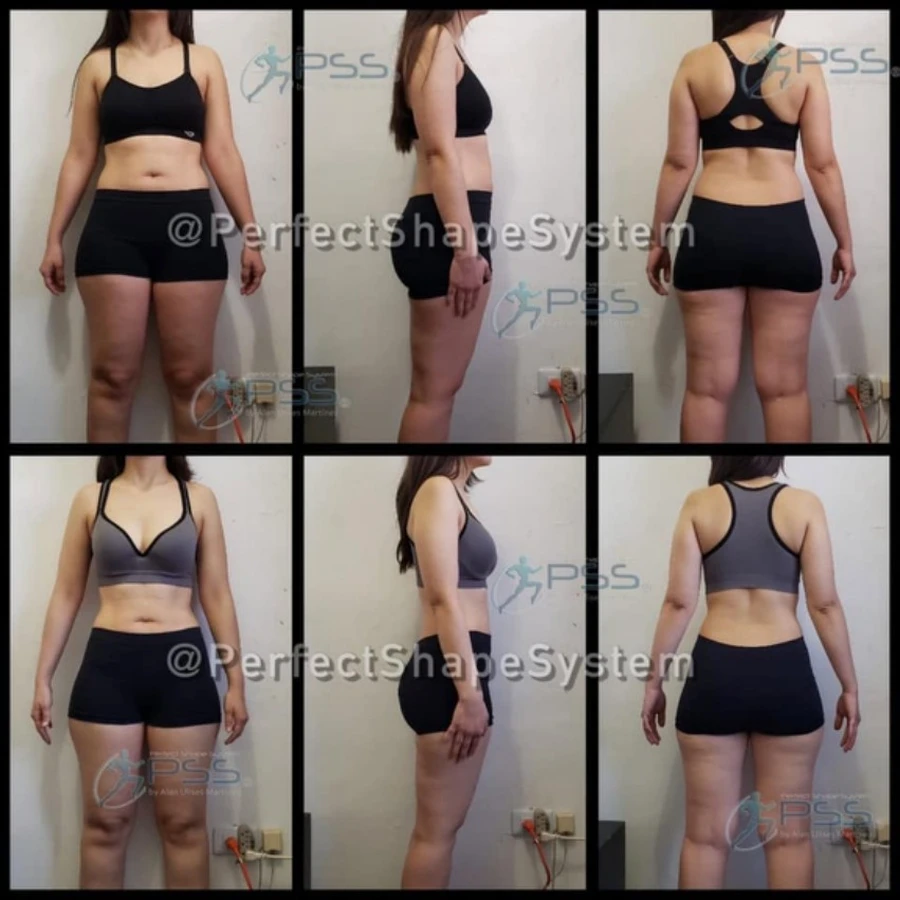 Testimonio Glute Max - Escultura Glútea y Reducción de Cintura