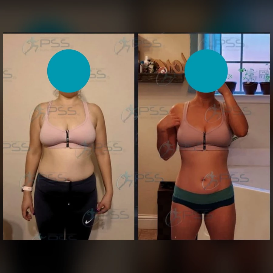 Testimonio Lipo Reductor - Afinamiento de Cintura y Abdomen Plano