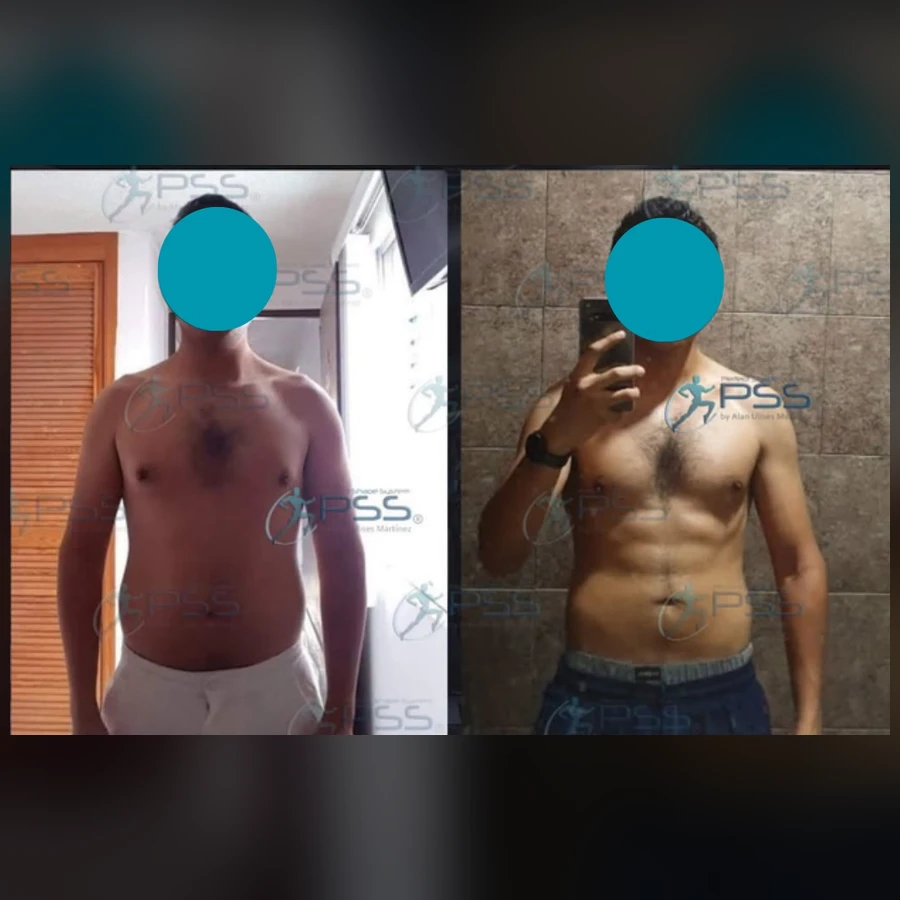 Testimonio Lipo Reductor - Marcación Abdominal Masculina