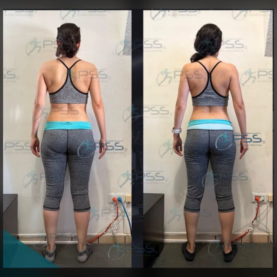 Testimonio Glute Max - Recomposición Posterior Femenina